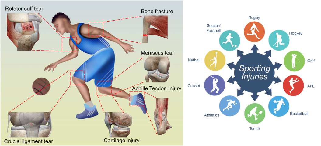 Understanding Sports Medicine: Beyond Injury Care