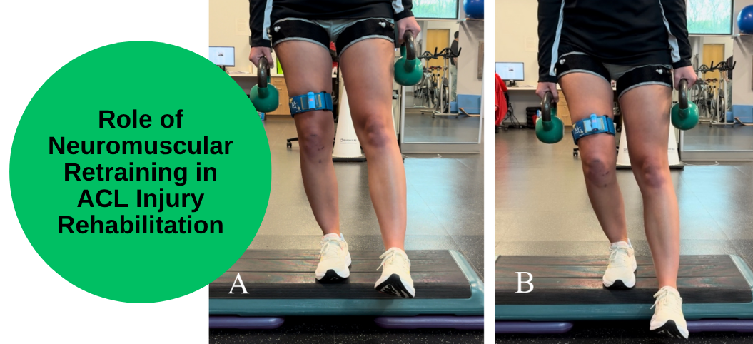 Role of Neuromuscular Retraining in ACL Injury Rehabilitation