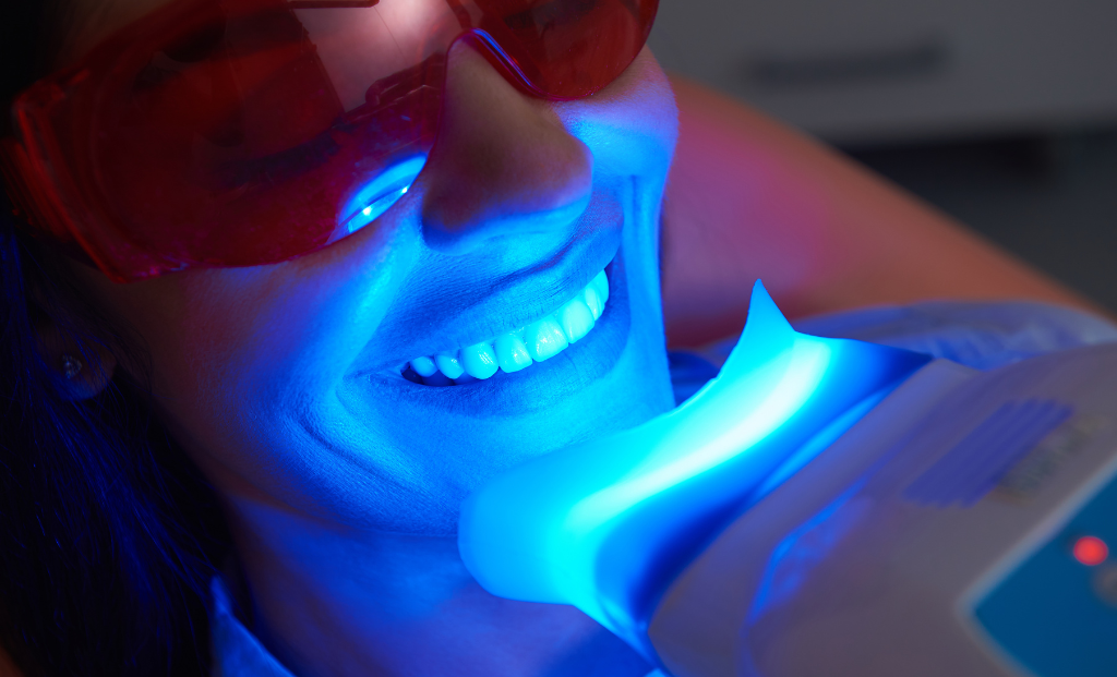 What is Laser Teeth Whitening?